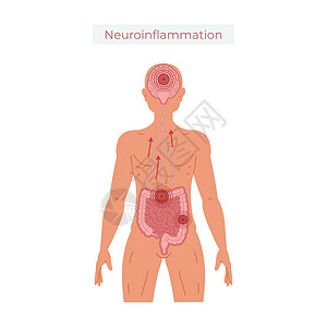 迷走神经肠道健康不佳导致神经发光矢量说明身体肠子疾病信息插图医疗药品图表解剖学胆量设计图片