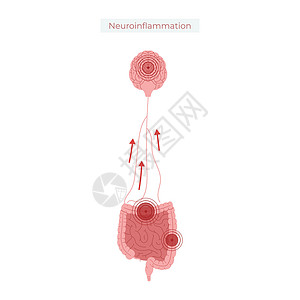 迷走神经肠道健康不佳导致神经发光矢量说明胆量插图药品肠子信息图表解剖学冒号医疗疾病设计图片