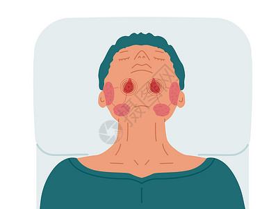舌下患有亚语言类流利性腺病的病人 用矢量说明硅叶丝虫病设计图片