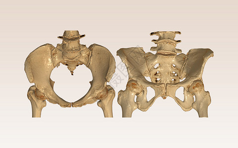 髋关节解剖学CT 骨盆骨骼扫描与臀部连接3D成像插件和输出视图背景