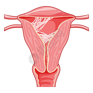 帕内通子宫内女性生殖系统疤痕组织粘合症 前视切片切口 表1 人体解剖器官插图女性输卵管图表生物学药品生殖器腹部女士骨盆插画