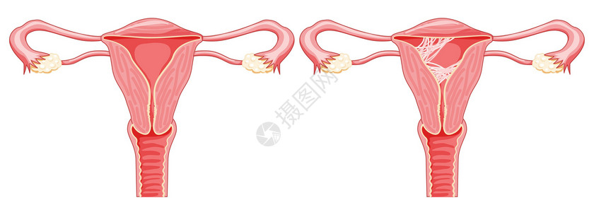 女性骨盆卵巢图表高清图片