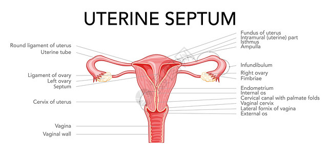 闭经子宫隔膜隔膜子宫女性生殖系统图与铭文文本 切割中的前视图 人类插画