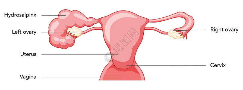 女性生殖系统堵塞了输卵管子子宫 并描述其特征;人体解剖内器官插画