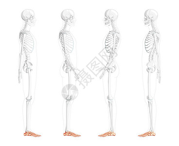 足跟痛人类侧面的横向视图 部分是透明的骨头姿势 这一系列解剖正确立方体(3D)插画