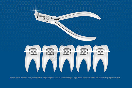 长门有希小姐3d 矢量图 逼真的牙齿 上下颌有牙套 对齐牙齿的咬合 牙列与牙套 牙套牙疼诊所牙刷矫正支撑医生曲线牙医卫生微笑插画