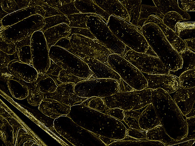 特写 3d 微观细菌 3D 渲染细菌特写 病毒或细菌细胞高分辨率科学插图显微镜生物癌症计算机生活攻击实验蓝色研究痘痘背景图片