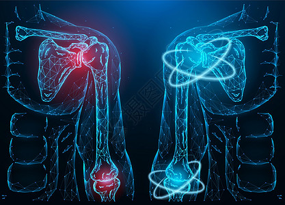 患病发炎的人肩肘关节的多边形矢量图和肩肘功能的恢复 医疗横幅 模板或背景插画