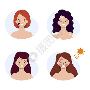 白癜风患有各种皮肤疾病的妇女 脸上有发炎和过敏症状太阳插图治疗胎记晒斑药品英雄女孩青年粉刺插画