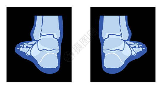 射线脚腿骨骼人体骨骼-踝骨 趾骨成人伦琴后视图 现实的平蓝色插画