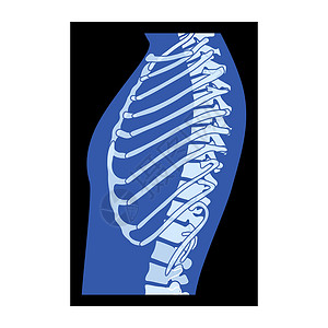 的脊椎骨XRay Rib 笼子骨质素人体 -胸脊椎骨 骨骼成年人的伦琴侧视角插画
