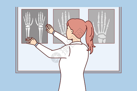 学古筝女孩女性外科医生用X光手对发光板进行X光检查 以观察骨折地点设计图片