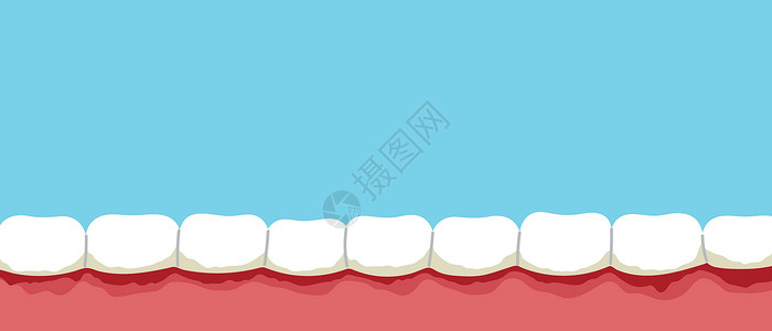 Gum 疾病卡通横幅 周期性炎 口香糖出血 牙齿上的板块背景图片