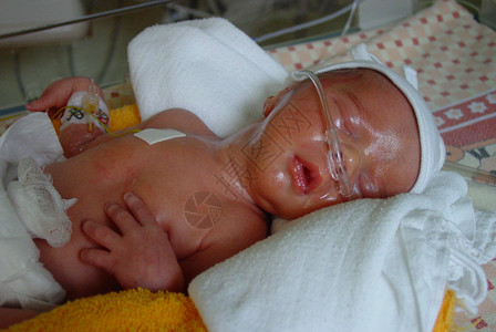 早幼婴儿新生饲养员孵化器救援产科治疗新生儿医院高清图片