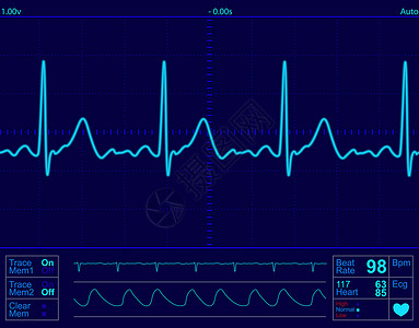 蓝色心电图心脏监测屏幕信号监控蓝色医生测试病人诊断诊所疾病情况背景