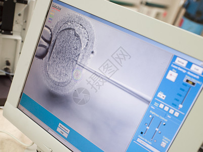 体外受精显示细胞图层精子注射的监视器医疗诊所细胞质电脑设备不育症集成电路怀孕治疗卵子背景