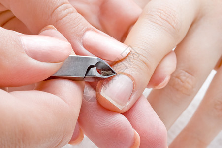 人类拇指修指甲 剪切切割发炎护理女性美容院宏观温泉美甲打扫倒刺治疗背景