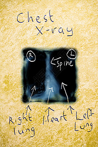 X射线教育笔记写作胸部羊皮纸墨水注释x射线医生扫描背景图片