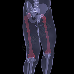 x型腿人腿X光髂骨拐杖骨骼医生科学身体肋骨膝盖骨头躯干背景