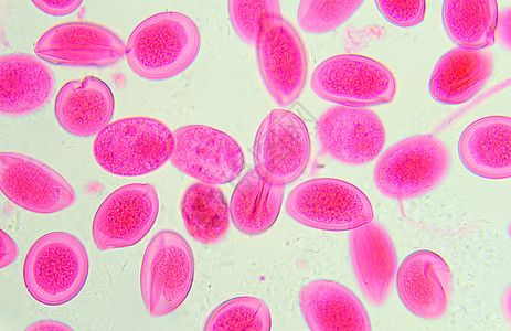 本底显微镜下的阿斯caris蛋高清图片