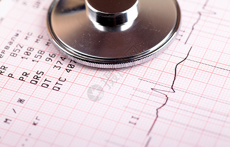 ECG 图形图工具水平金属卫生医生蓝色诊断疾病技术韵律背景图片