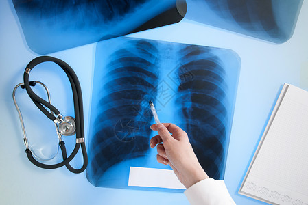 肺检查肺部X光照片临床x射线医师电影从业者辐射诊所射线医院诊断背景