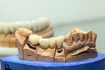 口腔瓷贴面牙科仓库中的聚丙酸牙板板实验室牙医生产修复学口腔产品技术员犬类假肢宏观背景