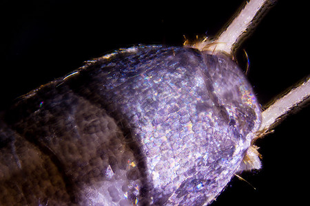 原生美眸术银鱼金属显微皮肤科学照片癌症猪鬃天线动物害虫背景
