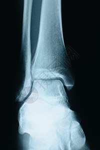 骨骼线向外切线x射线脚趾形态学黑色韧带人体数字生理视图科学人骨背景