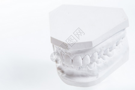 牙周刮治白色背景上的人类下巴的Gypsum模型实验室保健工程磨牙矫正投掷技术卫生口腔科牙医背景