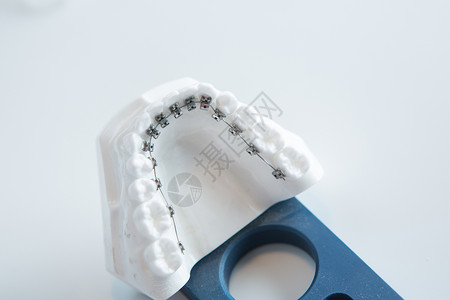 工具托架在白色的牙科下颌托架模型口腔科钛丝乐器门牙健康凹痕医生犬类办公室治疗背景