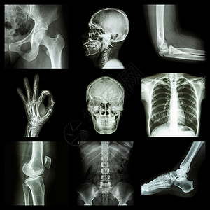 人体成分分析仪人体X射线部分科学男人膝盖骨科扫描外科病人卫生射线手术背景