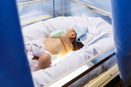 新生儿黄麻儿科医院治疗孩子送货医生药品房间黄疸诊断背景图片