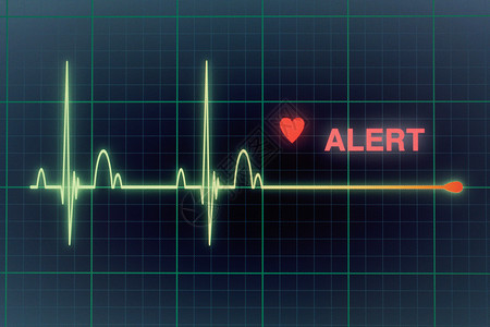 显示器上的心脏比心动图要强攻击屏幕诊断卫生蓝色心脏病展示逮捕警告心电图背景图片
