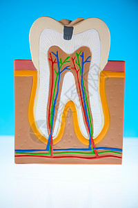 牙齿结构人牙结构 亮亮多彩的音调概念打扫动脉牙齿树脂牙龈空腔衰变假肢牙科牙医背景