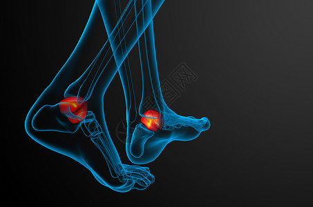 阿喀琉斯3d 表示 talus 骨头的插图肌肉医疗距骨意义解剖学踝骨肌腱教育背景