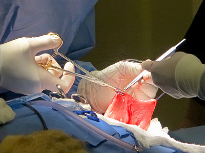 胃部抽取组织程序保健伤口母狮药品管子缝合器官手术高清图片