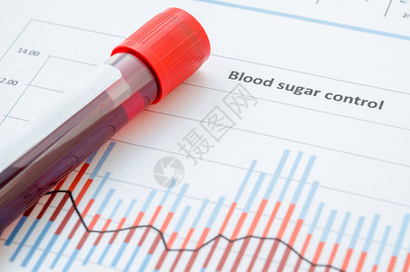 用于检测糖尿病测试的样本血液实验室同源性老年控制医生柳叶疾病医院监视葡萄糖背景图片