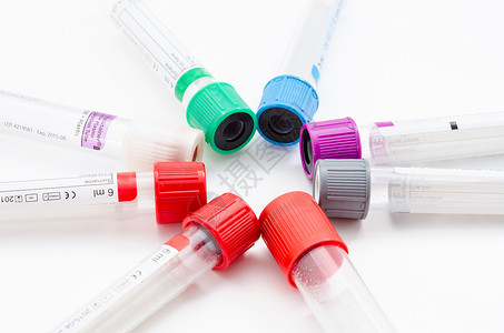 小区物管医疗血液管 化验室的测试管样本蓝色诊断病理紫色血糖白色血清绿色实验室背景