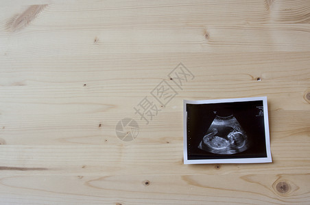 木木上的声图医疗超声胎儿医生女士生活怀孕产科扫描照片背景图片