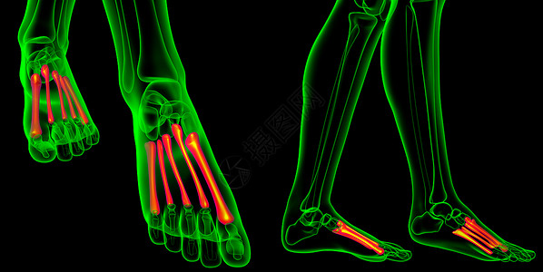 跖骨健康人类高清图片