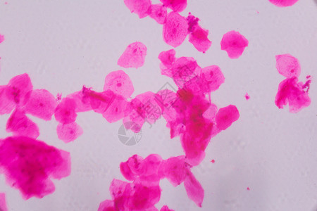 显微镜下的多鳞状上皮摘要 pi地层生物学团体病理插图生物艺术科学实验室宏观背景