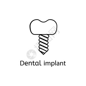 牙科植入图标 插图高清图片