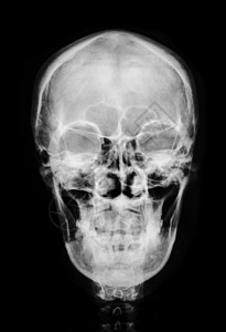 头颅骨正面正面头骨X光片背景