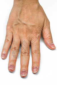 显性的有血脉的妇女手隔绝在白色背景 有中指毛的手指是显性基因 成年女性手背皮肤干燥和皱纹需要水疗或石蜡治疗背景