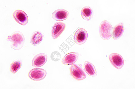 显微镜摄影 阿斯卡里斯蛋高清图片