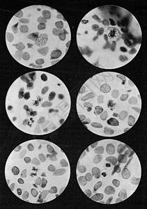 6个分级的六阶段 在发现沙子的刺状瘸腿细胞中高清图片