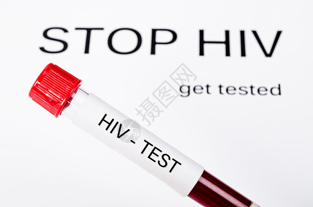 治愈性插画停止艾滋病毒检测时进行艾滋病毒测试的样本血样背景