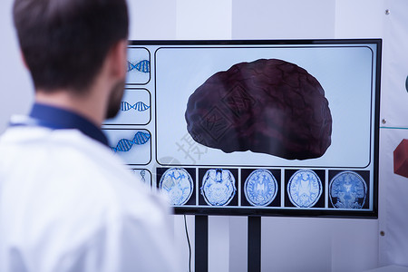 在神经外科手术后检查大脑的年轻医生高清图片
