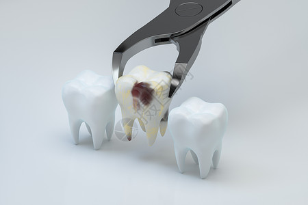 牙齿3D病齿被拔出 3D转化背景